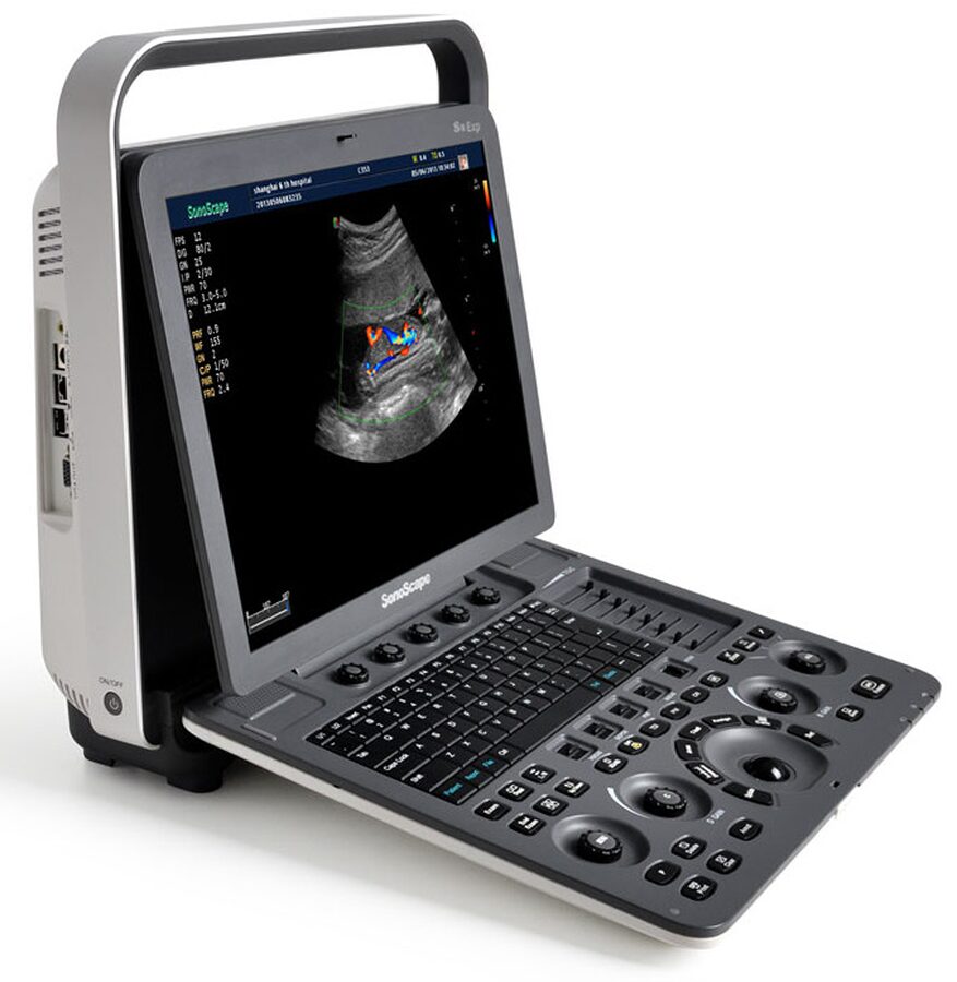 Xcelsitas | SonoScape S8 Exp color doppler HCU ultrasound device ...